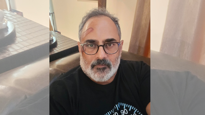 ‘Pain as a consequence’: BJP Kerala chief Rajeev Chandrasekhar injured in treadmill fall, shares lesson