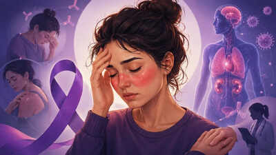 Representative image (AI-generated) World Lupus Day: Why this autoimmune disease hits women harder?