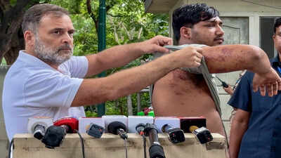 Rahul Gandhi along with a victim of alleged pellet gun firing during a students protest 'Who approved pellet guns?' Rahul Gandhi writes Amit Shah over 'barbaric assault' on students