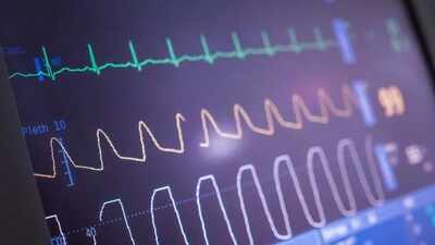 The procedure, however, clearly reduces AF. Seven-day heart monitoring detected AF in 21% of patients after ablation, compared with 41% after the dummy procedure. Heart ablation cuts irregular beats, but may not make patients feel better